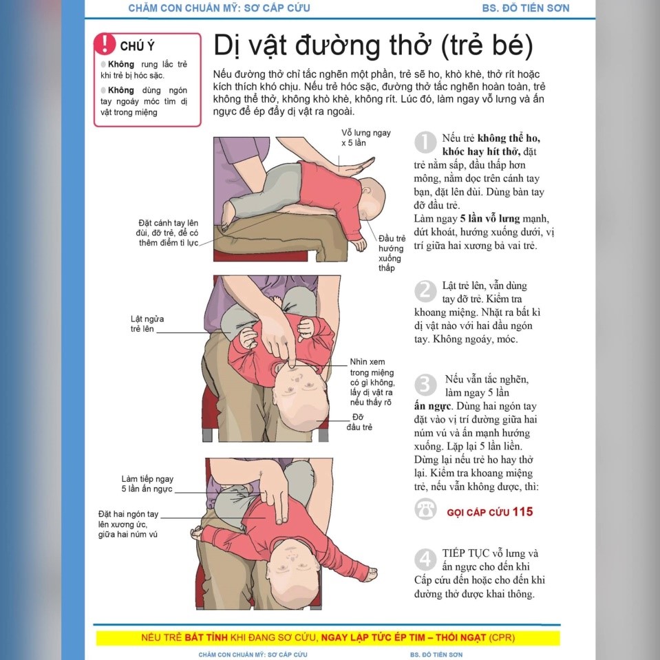 Cách sơ cứu cơ bản khi trẻ hóc dị vật đường thở